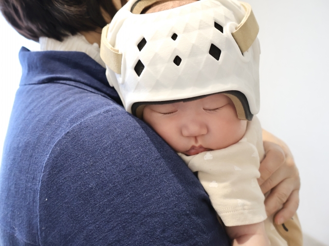 よくある病院でのヘルメット治療のイメージ画像